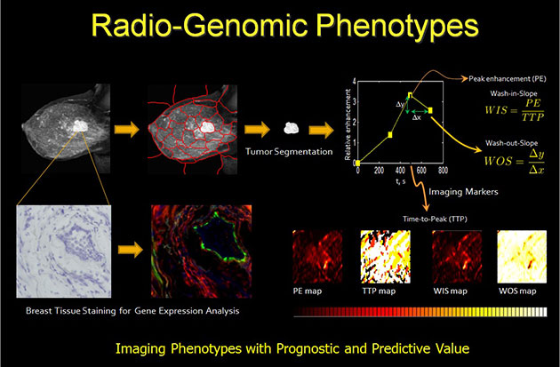 CBIG - Radio-Genomic Phenotypes Graphic